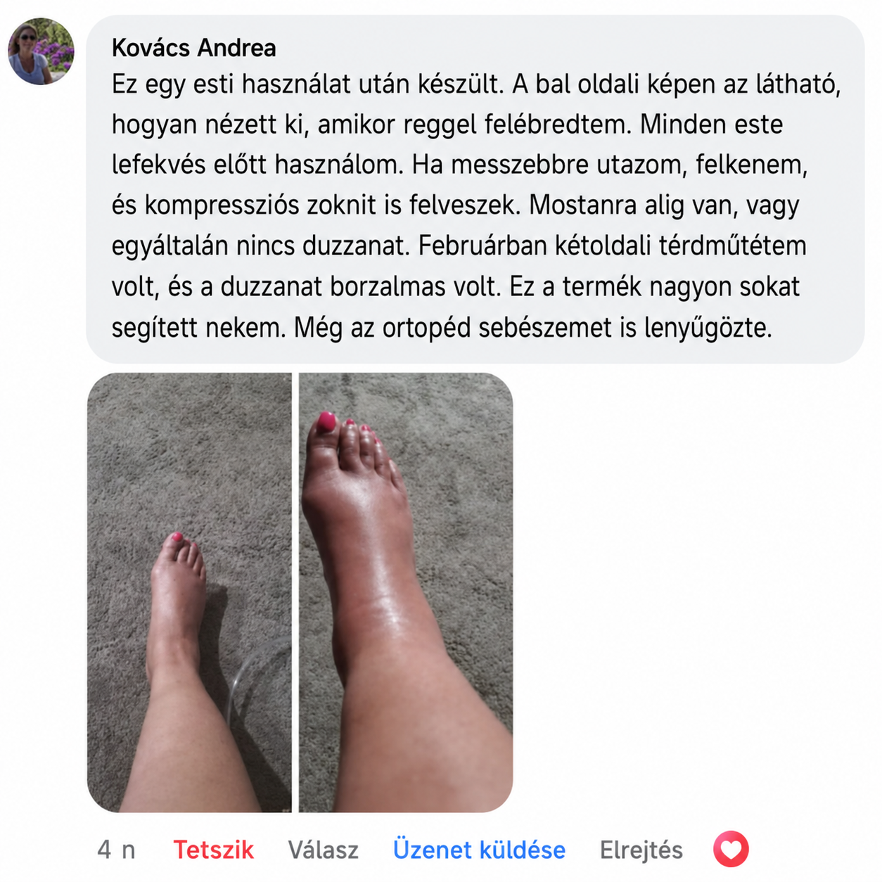 SOOTHE Miracle Balzsam