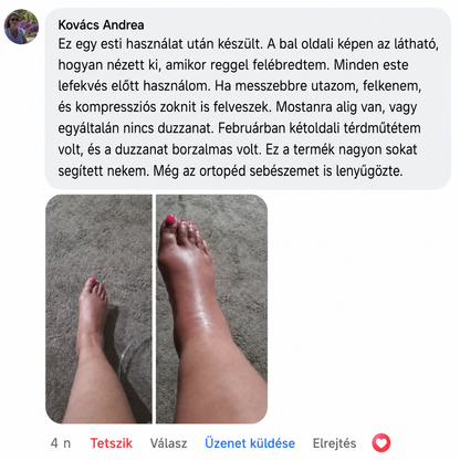 SOOTHE Miracle Balzsam